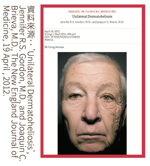 韓系美魔女護膚美學(二): 「童顏選拔大賽」冠軍之臉部瑜伽式子