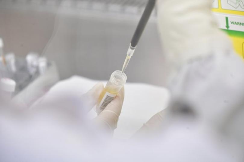 食衞局：不會因未發短信延誤救治