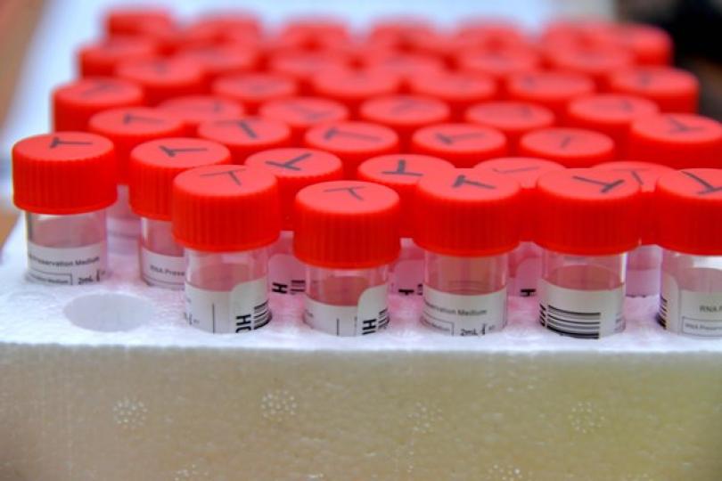 醫管局報告檢測滯後個案